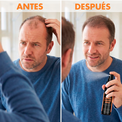 Spray Crecimiento del Cabello - Crown Elixir